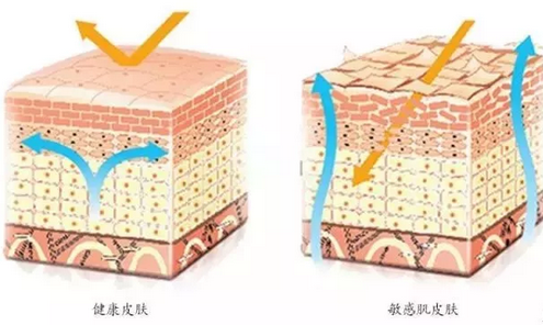 敏感肌膚與健康肌膚的對(duì)比，導(dǎo)致肌膚敏感的原因有哪些