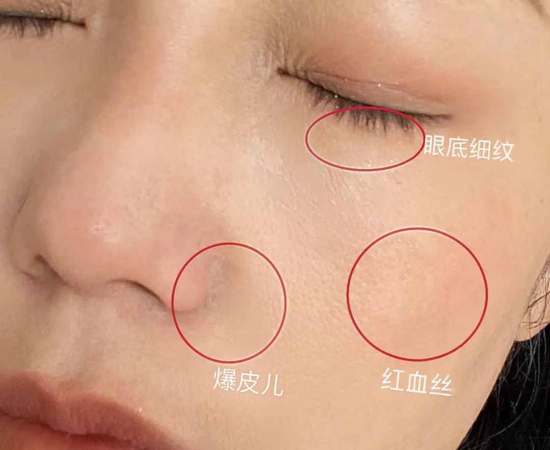 如何判斷自己是不是干敏肌膚？干敏肌有哪些特征？