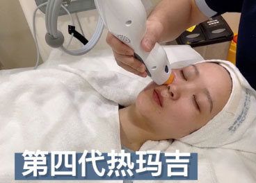 熱瑪吉的效果可以維持多久？熱瑪吉的效果可以保持一年嗎？